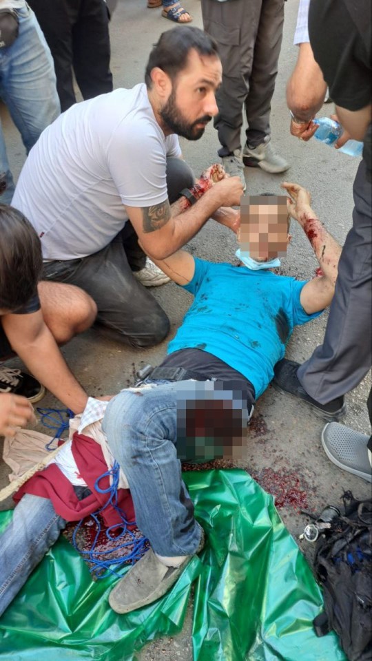 An injured man lays on the ground following the sabotage wave on Tuesday